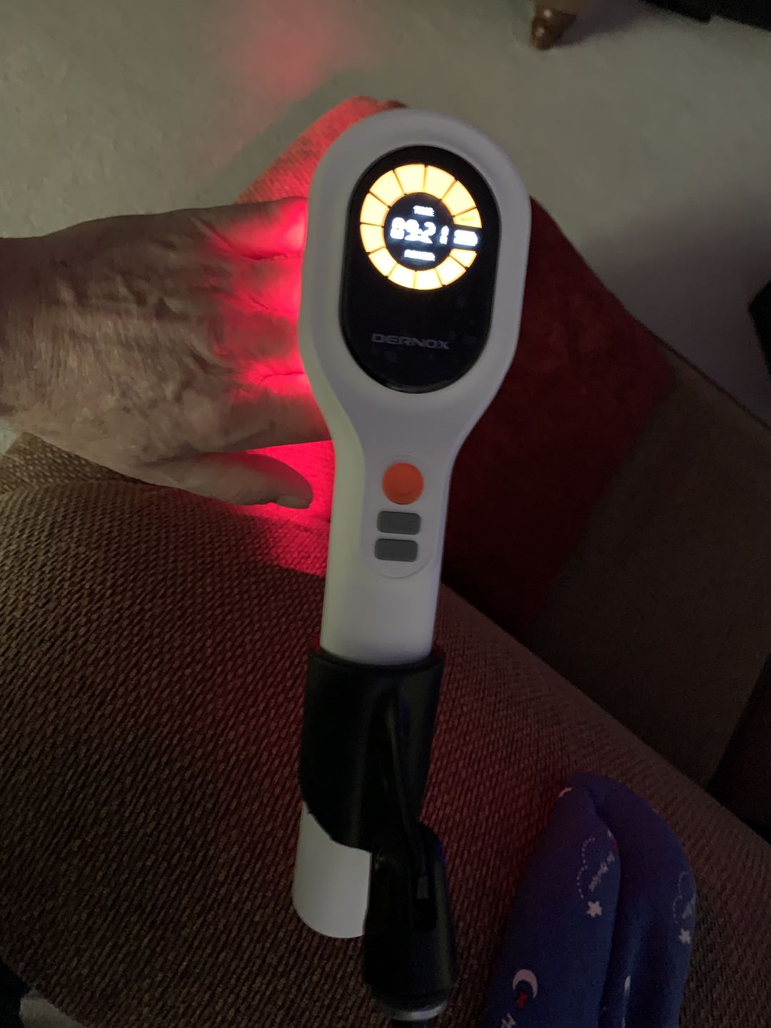 Customer photo review of DERNOX™ Handheld Pain Relief Cold Laser Device