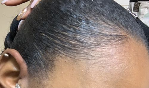 Customer photo review of Hair Strengthening Oil - Extra Strength