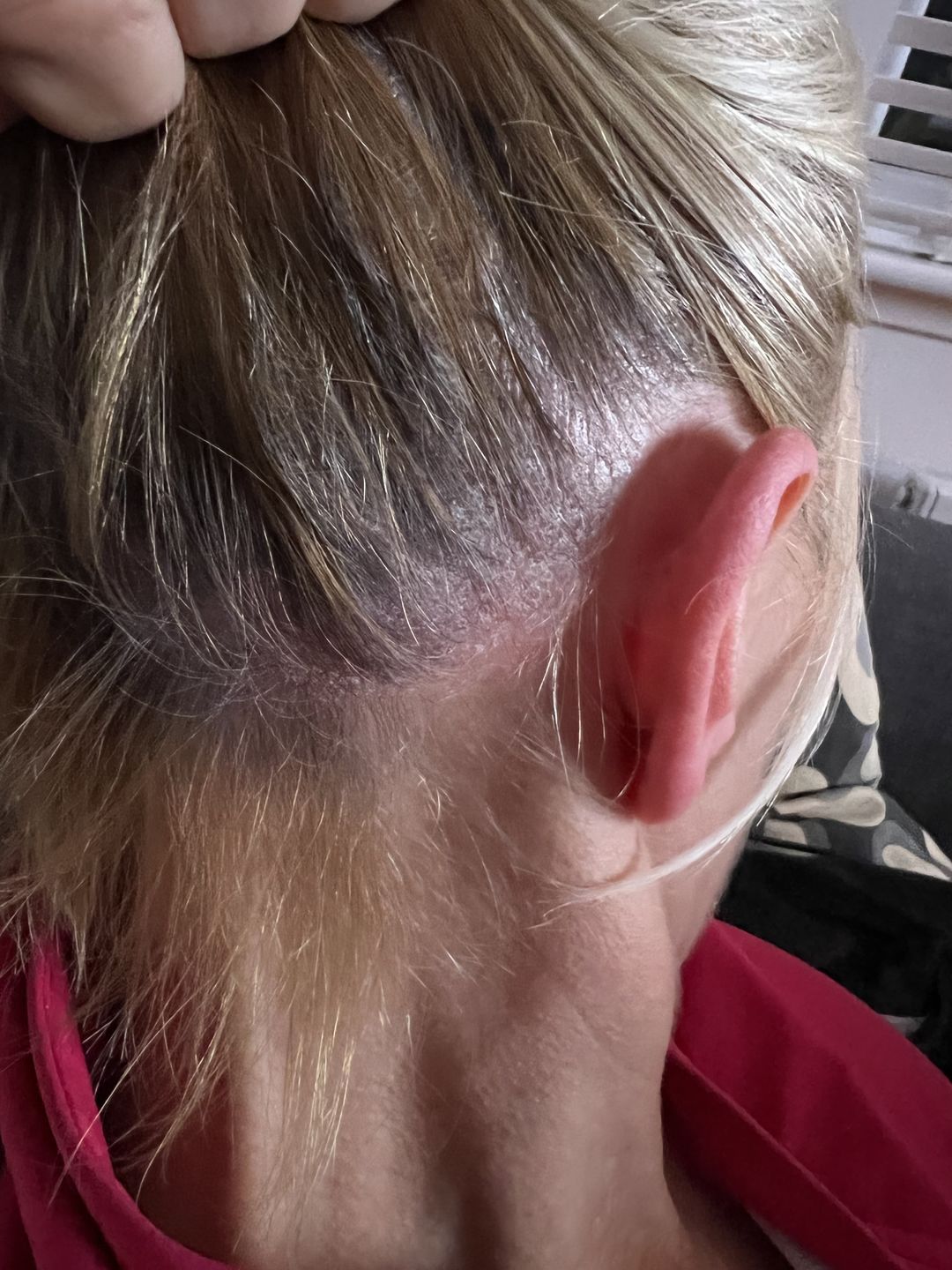 Customer photo review of Soothing Spray