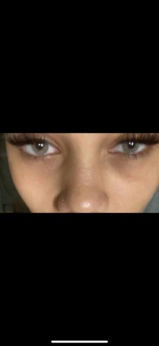 Customer photo review of Polar Lights Blue Gray Contact Lenses(12 months of use)