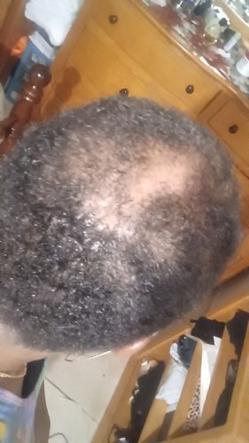 Customer photo review of (30%off) Regrowth (Bundle Pack) 3 IN 1