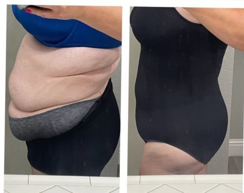 Customer photo review of Full Sculpting Bodysuit