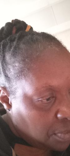 Customer photo review of Hair & Nail Herbs Tincture - Buy 1 Get 1 Free Offer