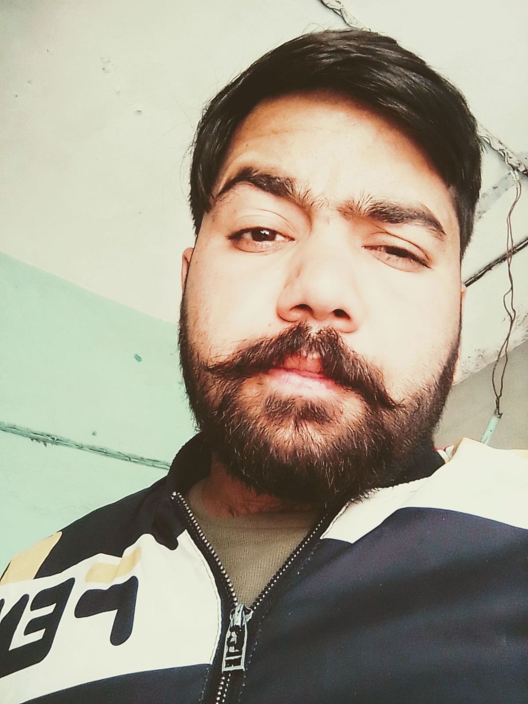 Customer photo review of Lightening Lip Balm (for Men) – Restores your Natural Lip Color, Ideal for Smokers, Hydrates, Softens & Lightens Dark Lips 20ml