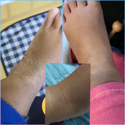 Customer photo review of Jolicare Cream
