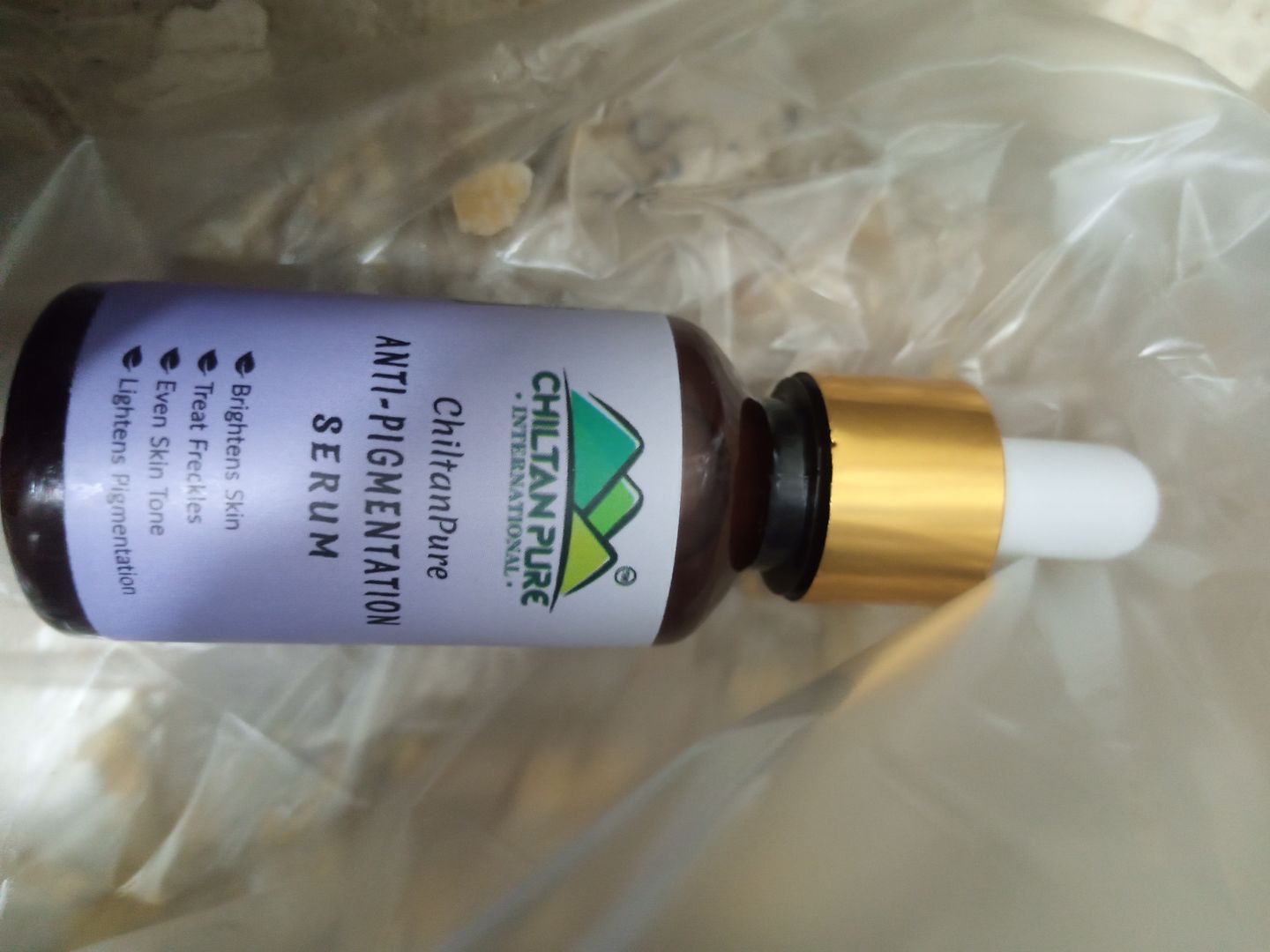 Customer photo review of Anti-Pigmentation Serum – Brighten Skin, Lighten Pigmentation, Fade Freckles & Even Skin Tone 30ml
