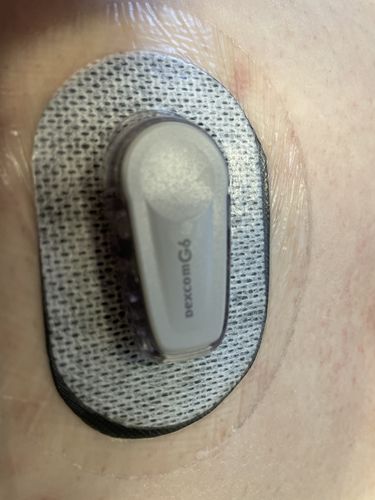 Customer photo review of Underlayer by FlexiArmor
