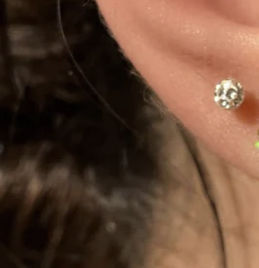 Customer photo review of Crystal Ball Piercing | Chirurgenstahl