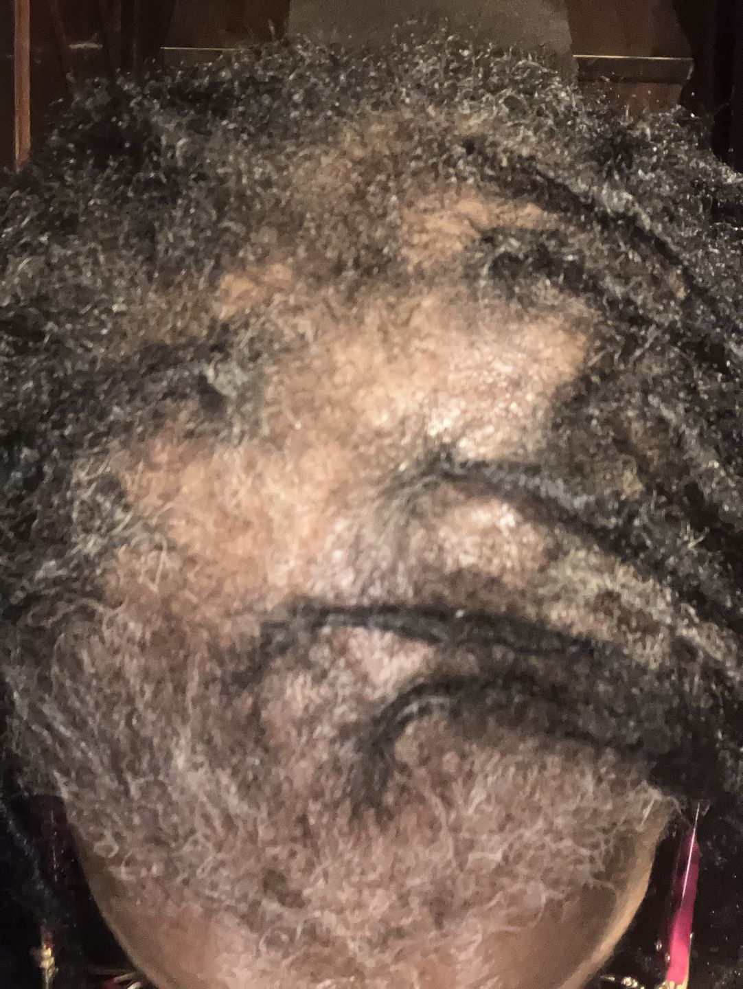 Customer photo review of Hair Growth Oil (2 Pack)