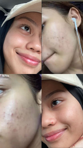 Customer photo review of Brightening Face Creme