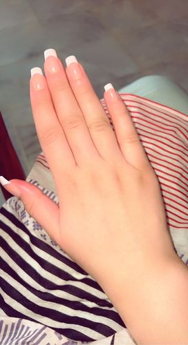 Customer photo review of O.TWO.O REUSABLE POP-ON NAILS