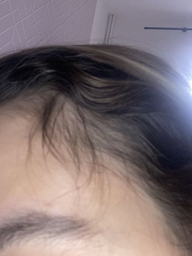 Customer photo review of Good Hair Vitamins - 1 mois