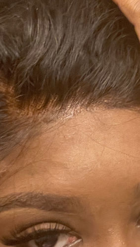 Customer photo review of Medium brown Lace Tint- Restock Nov 25th