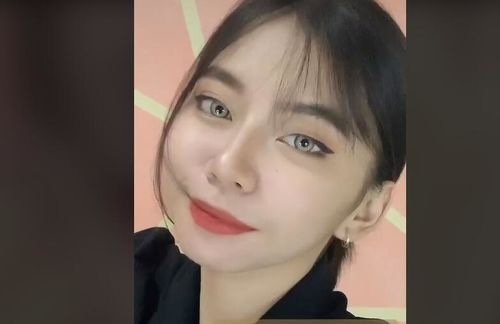 Customer photo review of Brown Crown Contact Lenses(12 months of use)