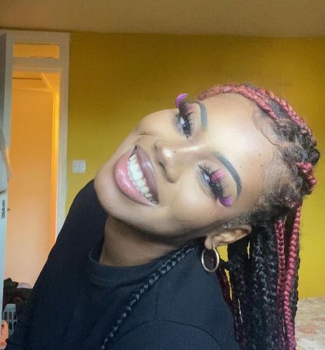 Customer photo review of Purple Rain Contact Lenses(12 months of use)