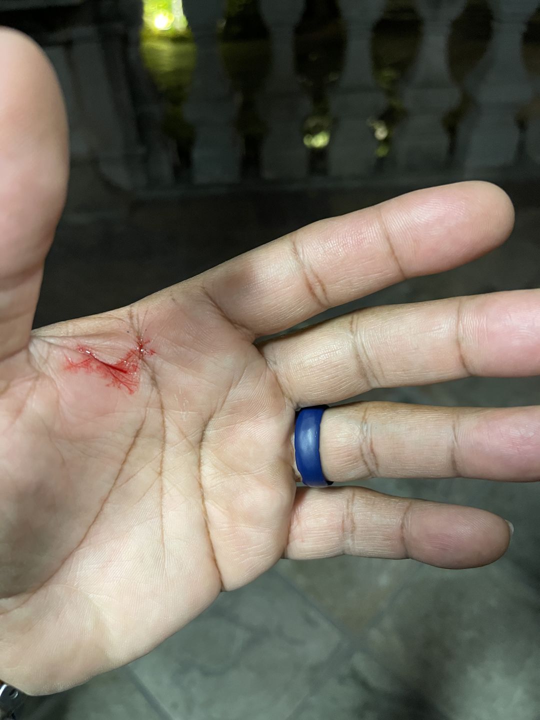 Customer photo review of MDV Trainer (Blue)