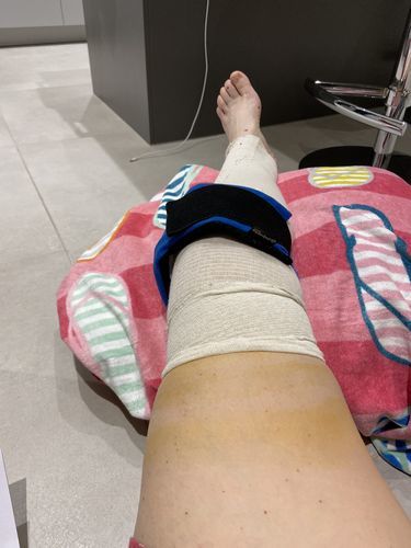 Customer photo review of GelpacksDirect Knee Ice Pack Wrap (Gel Pack with Compression Strap, Reusable Heated Knee Pads) - Hot and Cold Packs (13 x 26 cm) for Knee Pain Injuries
