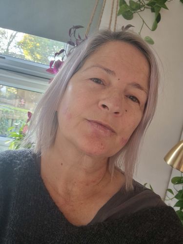 Customer photo review of Rosalique 3 in 1 Anti-Redness Miracle Formula SPF50