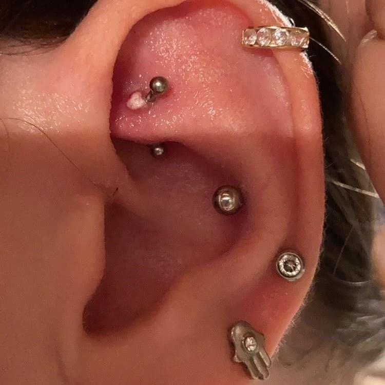 Customer photo review of Piercing Aftercare Spray - Soothes & Cleanses All Piercing Types   - 4oz