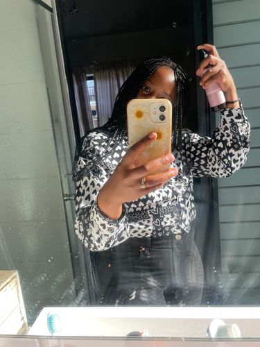 Customer photo review of Anti-Itch Hair & Scalp Mist (200ml)