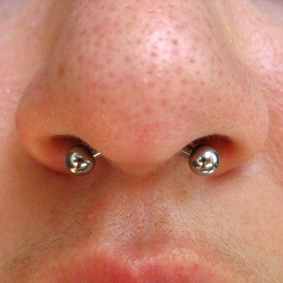 Customer photo review of Piercing Aftercare Spray - Soothes & Cleanses All Piercing Types   - 4oz