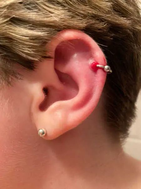Customer photo review of Piercing Aftercare Spray - Soothes & Cleanses All Piercing Types   - 4oz