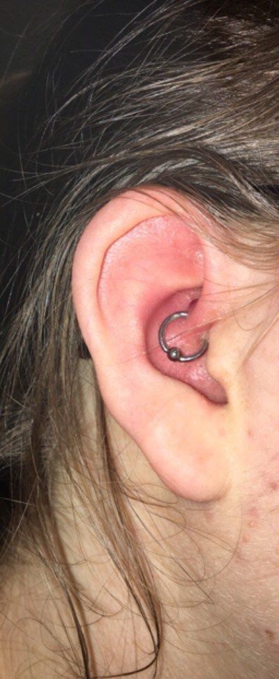 Customer photo review of Piercing Aftercare Spray - Soothes & Cleanses All Piercing Types   - 4oz