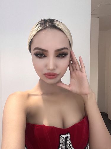 Customer photo review of Citha Gray Contact Lenses(12 months wear)