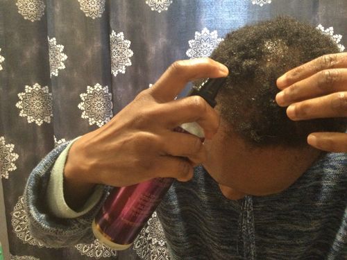 Customer photo review of Scalp Soothing Mist