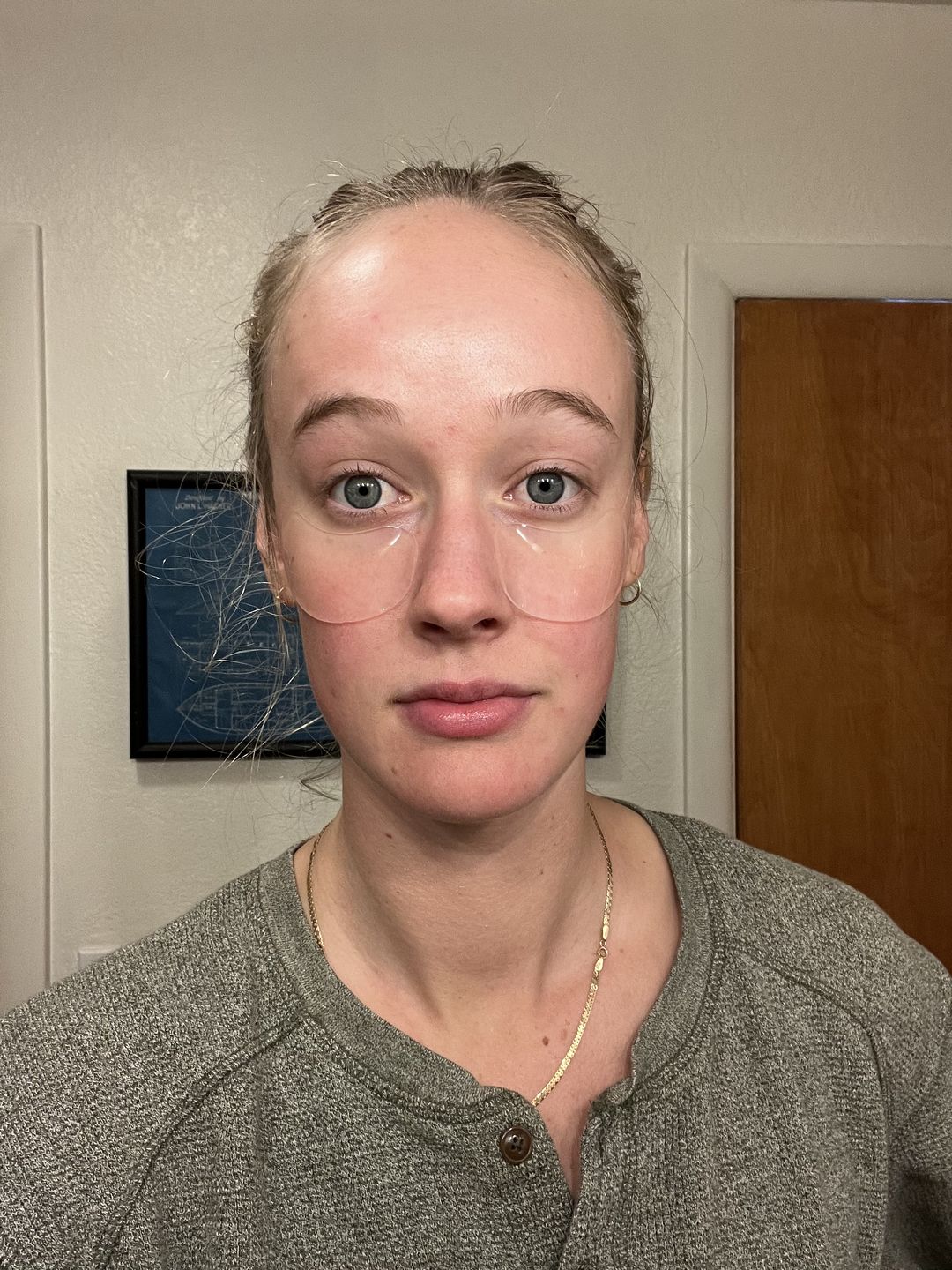 Customer photo review of LAZY GURL Gua Sha HOLIDAY GIFT SET  (LIMITED EDITION)
