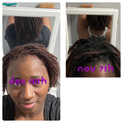 Customer photo review of India’s Secret Ancient Ayurvedic Hair Follicle Elixir (4 sizes)