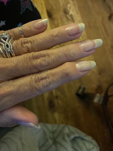 Customer photo review of Rocket Nail Fuel Nail Repair - Clear