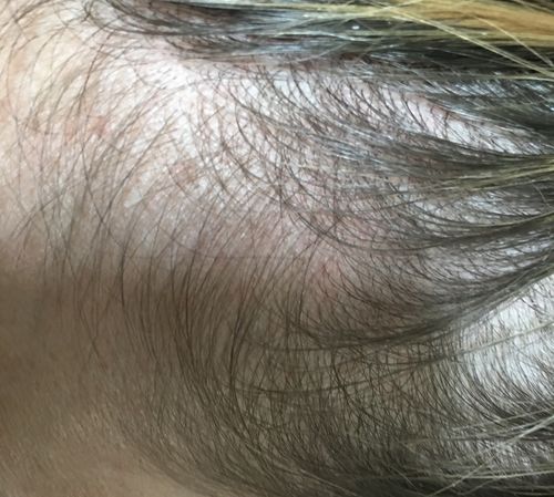 Customer photo review of Good Hair Vitamins Boost - 1 mois