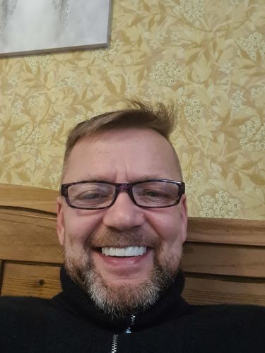 Customer photo review of Teeth-Veneer 2.0