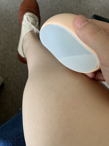 Customer photo review of Depilador Nuva Skin®