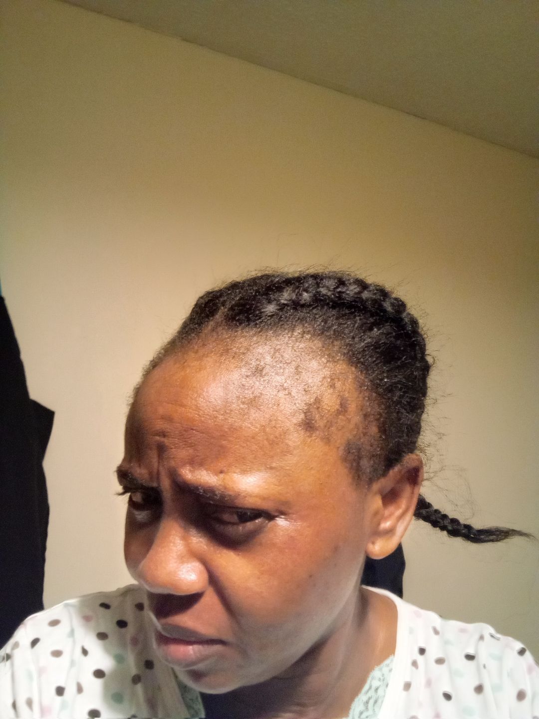 Customer photo review of Miracle Hair Bundle