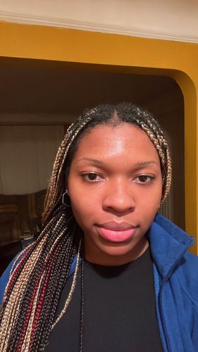 Customer photo review of FRESH FACE PACKAGE (Cleanser x Toner x Serum)