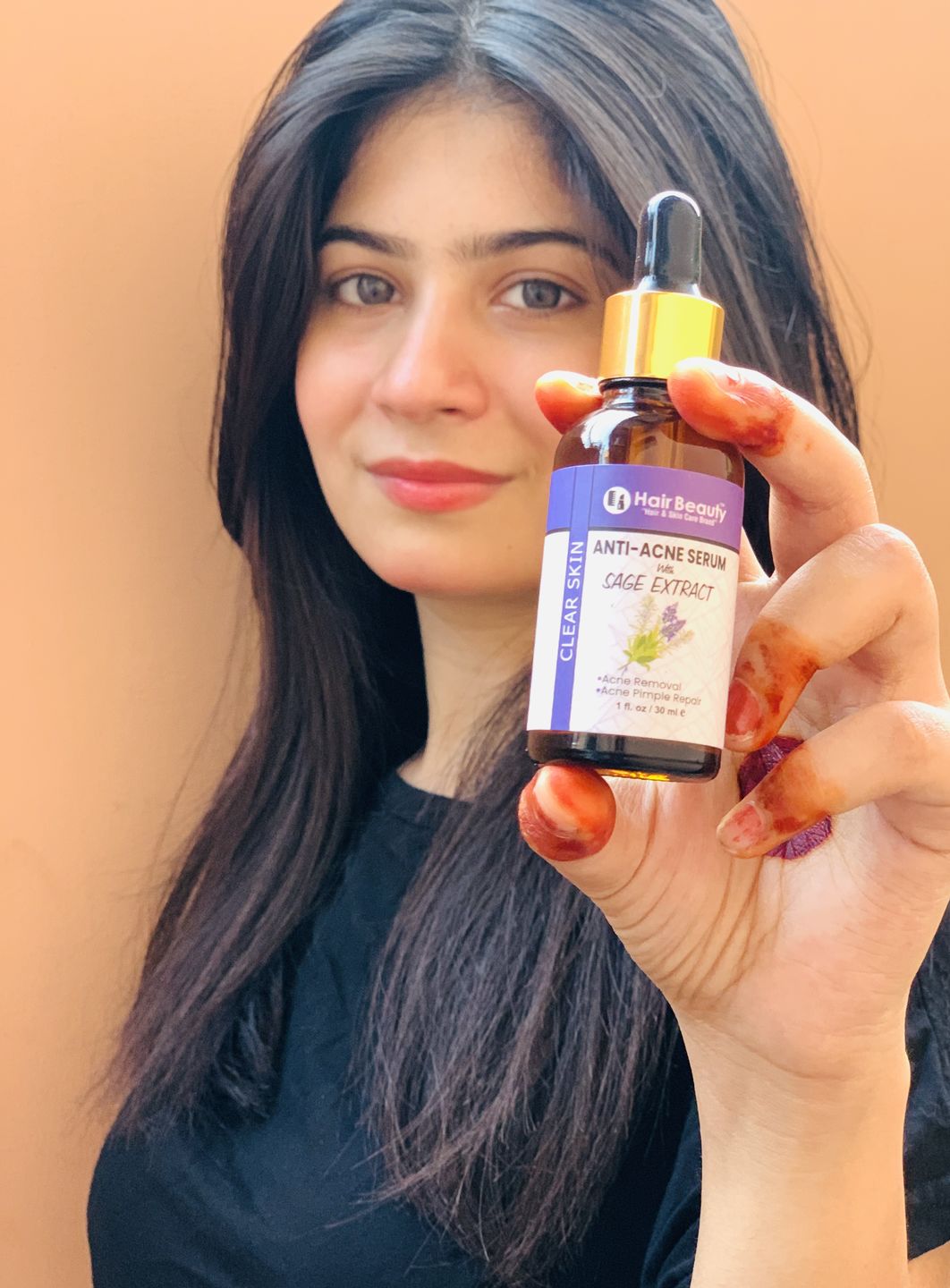 Customer photo review of Anti-Acne Serum