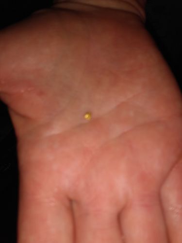 Customer photo review of 5-XL 'NUGGET RESERVE ELITE™' 5x the Nuggets Unsearched