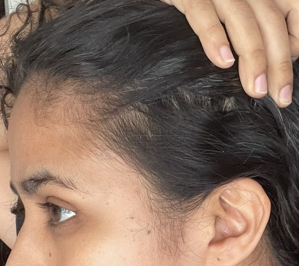 Customer photo review of Shampoo anticaída