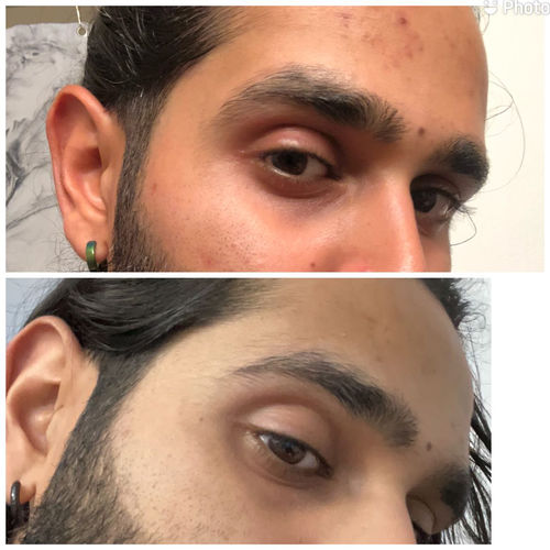 Customer photo review of Eyebrow Enhancing Serum