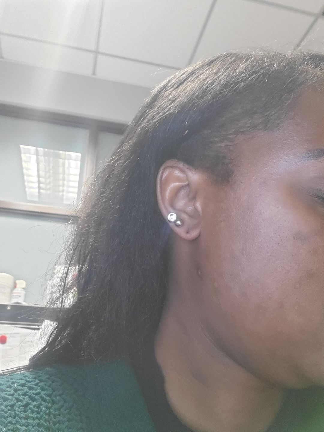 Customer photo review of BERRI-CLEAR+ 5 BERRY SUPERFRUIT SERUM