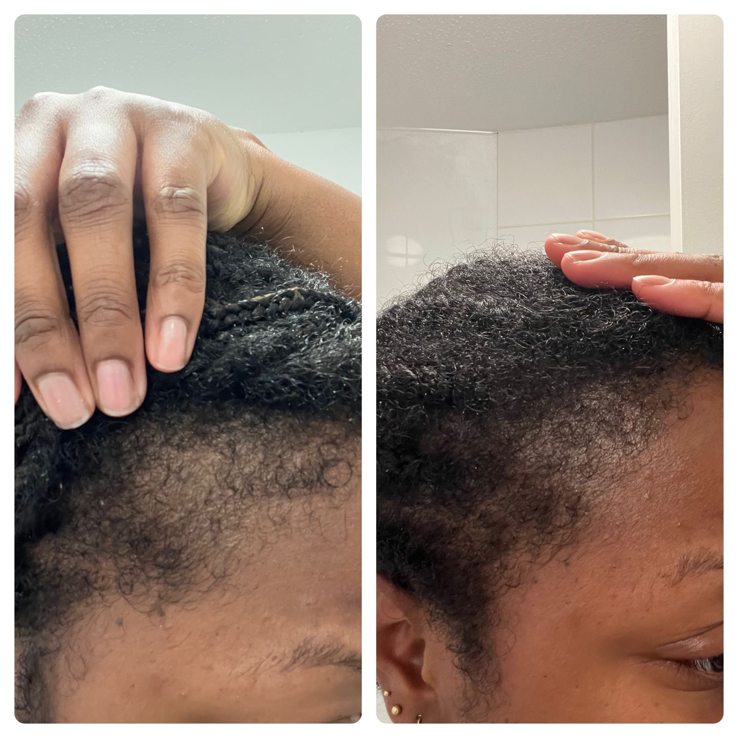 Customer photo review of Hair Growth Potion - Extra Strength