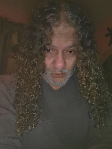 Customer photo review of 12.5% Minoxidil Extra Strength Topical Solution USP for Men.