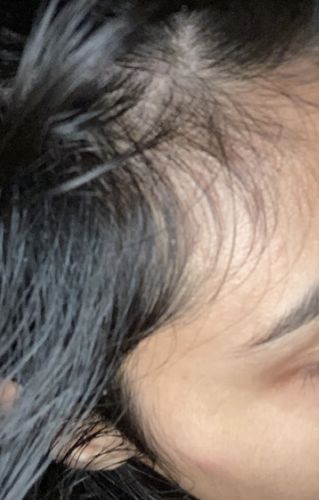 Customer photo review of Growth & Shine Hair Oil