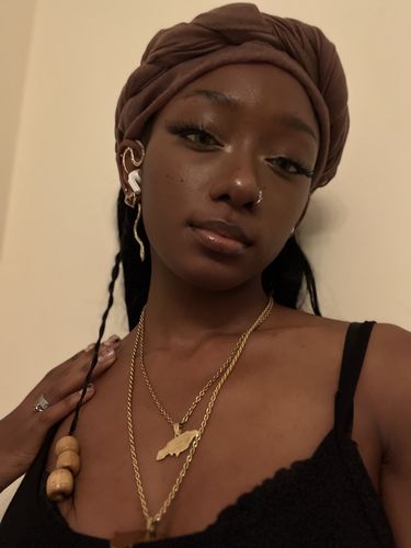 Customer photo review of Taylor Brown Contact Lenses(12 months of use)