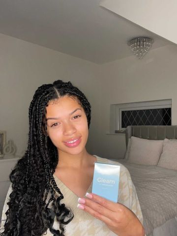Customer photo review of Teeth Whitening Strips