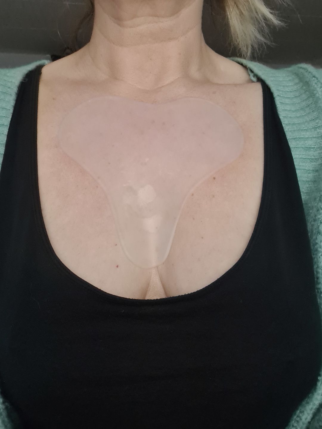Customer photo review of Decolleté Pad mit Hyaluron