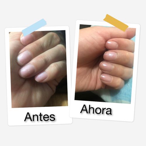 Customer photo review of Colección Tratamiento de Uñas + 1 Esmalte Gratis