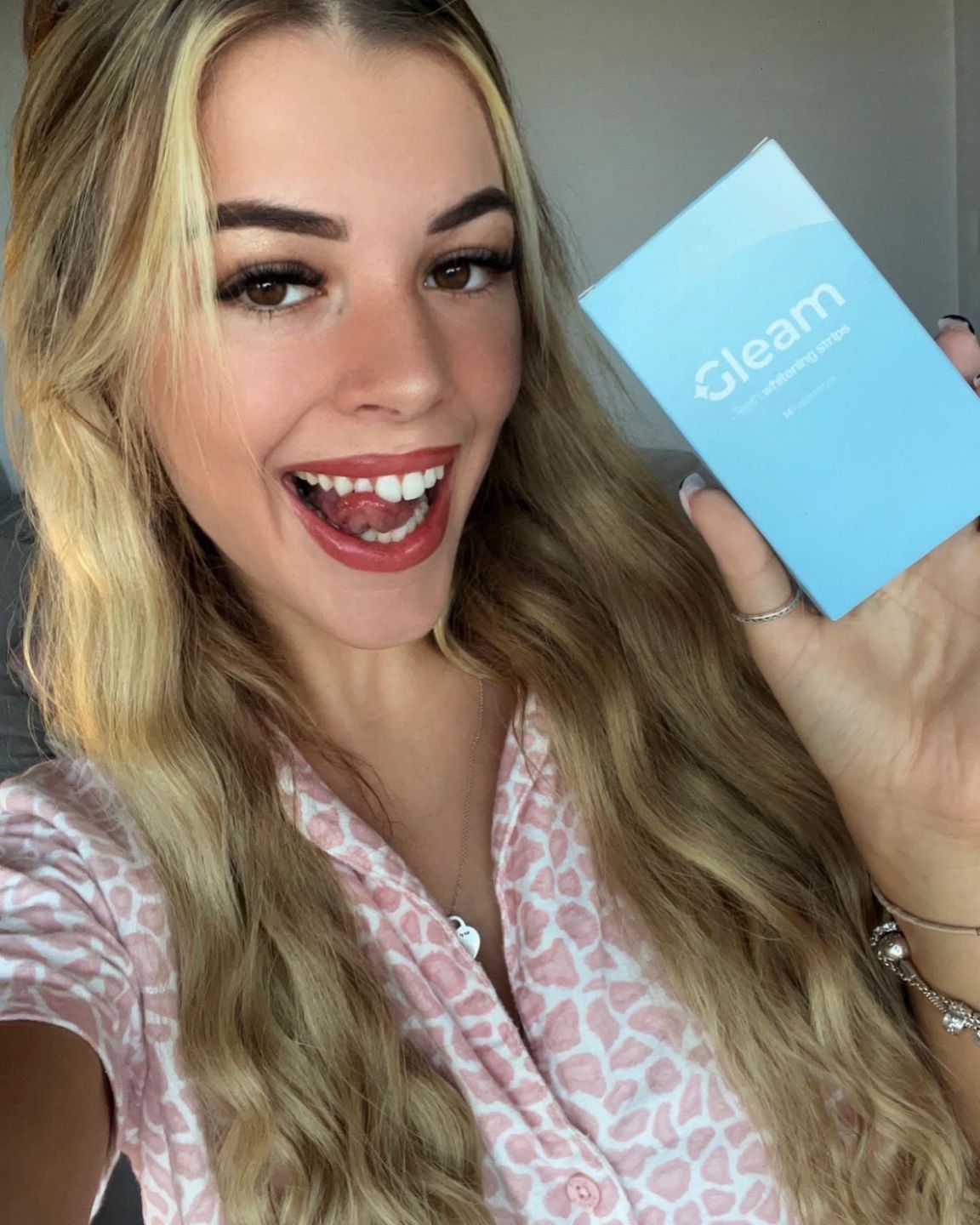 Customer photo review of Teeth Whitening Strips
